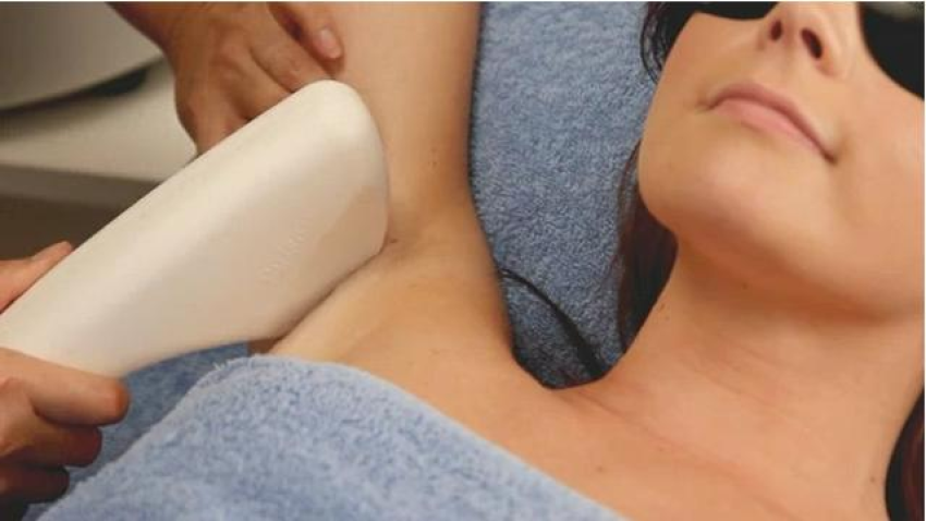laser hair removal contraindications